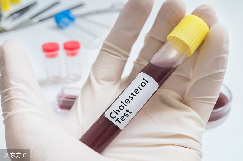 中老年降血脂最快的方法,中老年血脂高有什么办法能降下来