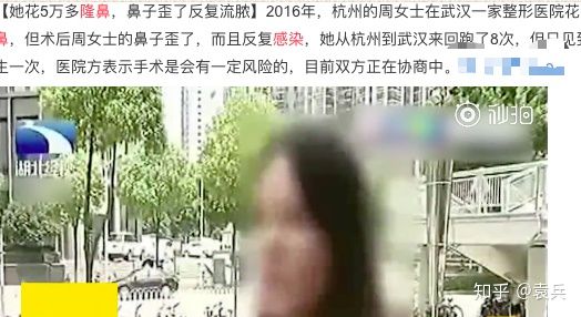 整形失败是不是就相当于毁容了,整形失败一般是在哪些地方