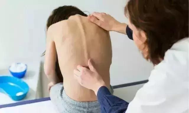 23岁姑娘撩起上衣,妈妈一看急疯了!暑假孩子一窝蜂看这病,再晚要吃大苦头!