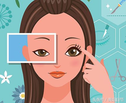 双眼皮埋线的亲身经历,对要做双眼皮埋线的几个建议