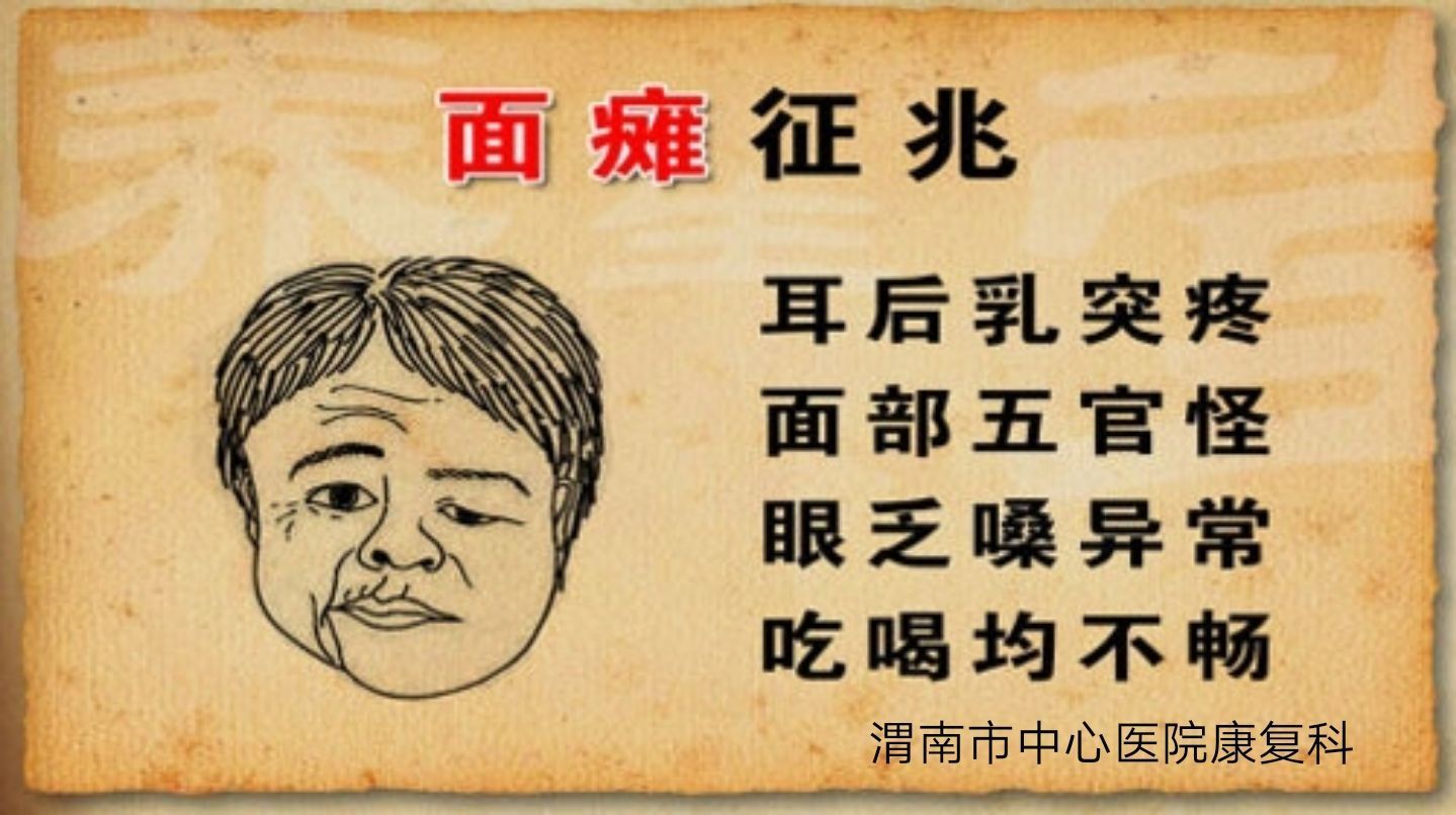 康复医学科治面瘫后遗症,渭南市中心医院治疗面瘫