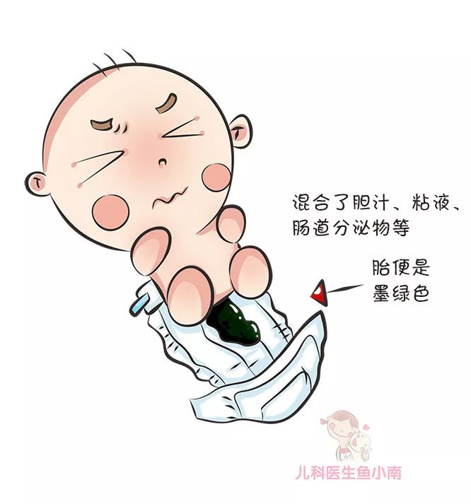 如何辨别婴儿大便性状,宝宝大便性状有哪些