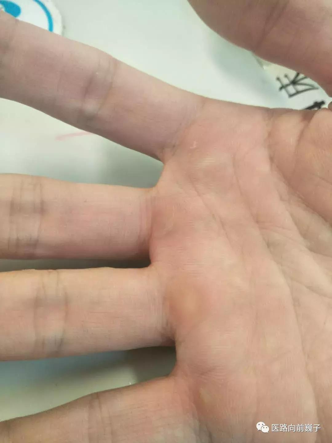 莫把120当做高级滴滴，莫把医护人员当做担架工