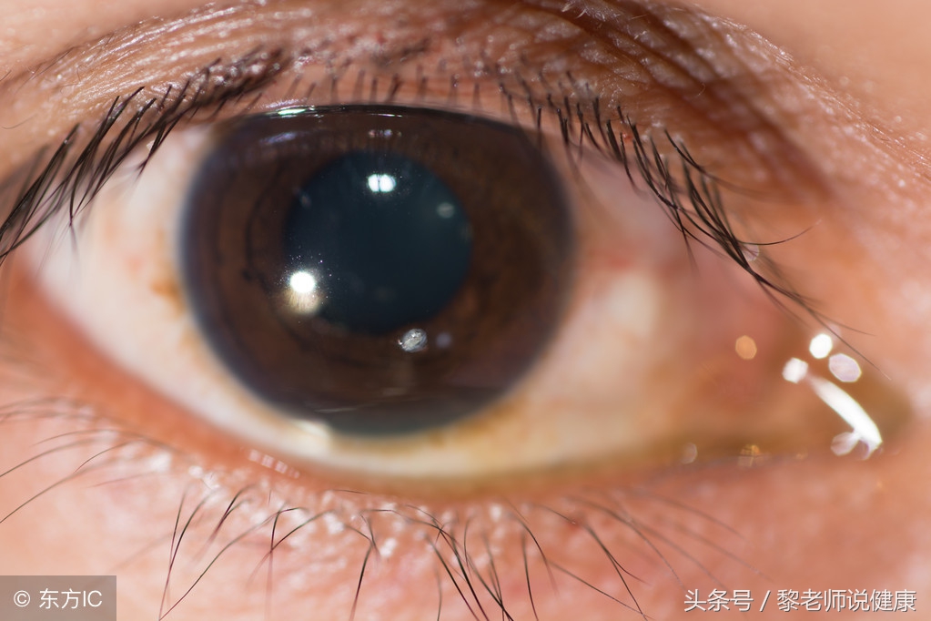 眼睛红痛而且流泪怎么治疗,眼睛疼眼角有红血丝怎么回事