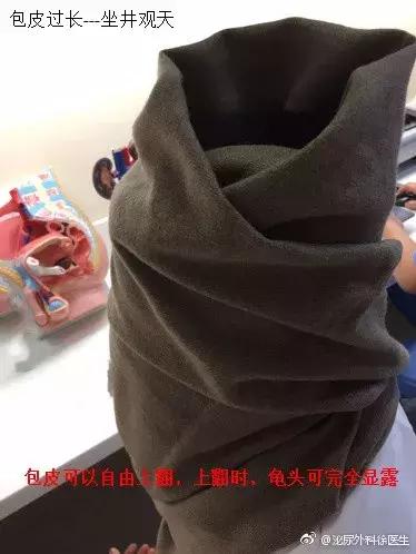 怎么判断自己的包皮要不要割,怎么才能知道自己的包皮要不要割