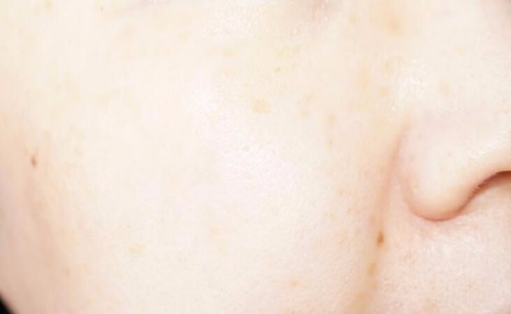 城野医生毛孔细致化妆水搭配精华,城野医生化妆水适合油皮