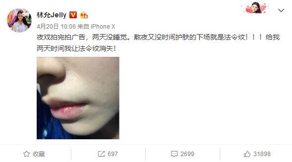 林允有没有鱼尾纹,林允法令纹