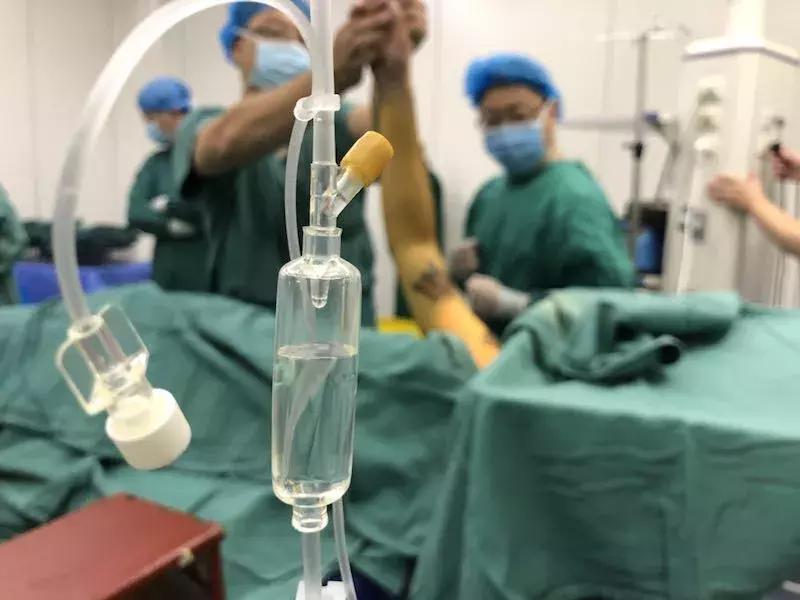 肩关节镜微创技术,徐州肩关节微创关节镜