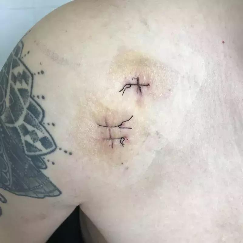 肩关节镜微创技术,徐州肩关节微创关节镜