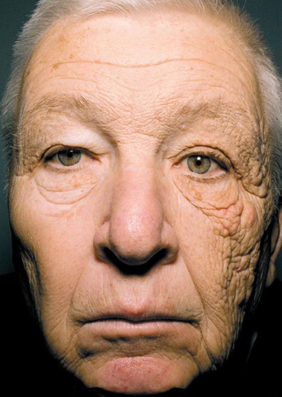 吃药能不能防晒,吃药能阻止防晒吗