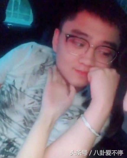 赵本山女儿球球整容的花费,爆料赵本山女儿球球