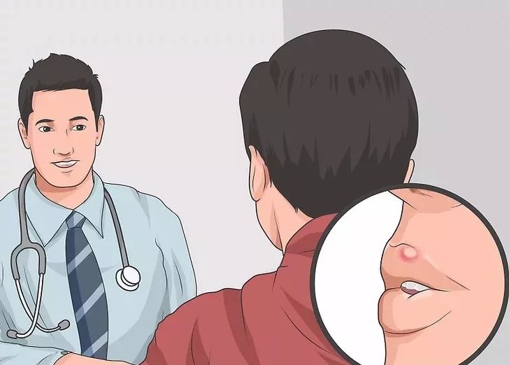 嘴巴上起泡快速消除小窍门,嘴巴上起泡了是怎么回事