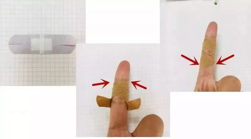 创可贴贴伤口上撕不下来太疼,创可贴适合大面积伤口吗