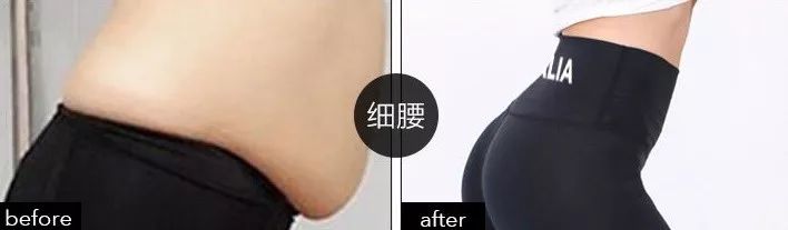 穿着就能瘦腿的裤子真的有用吗,穿瘦腿裤睡觉可以瘦腿吗