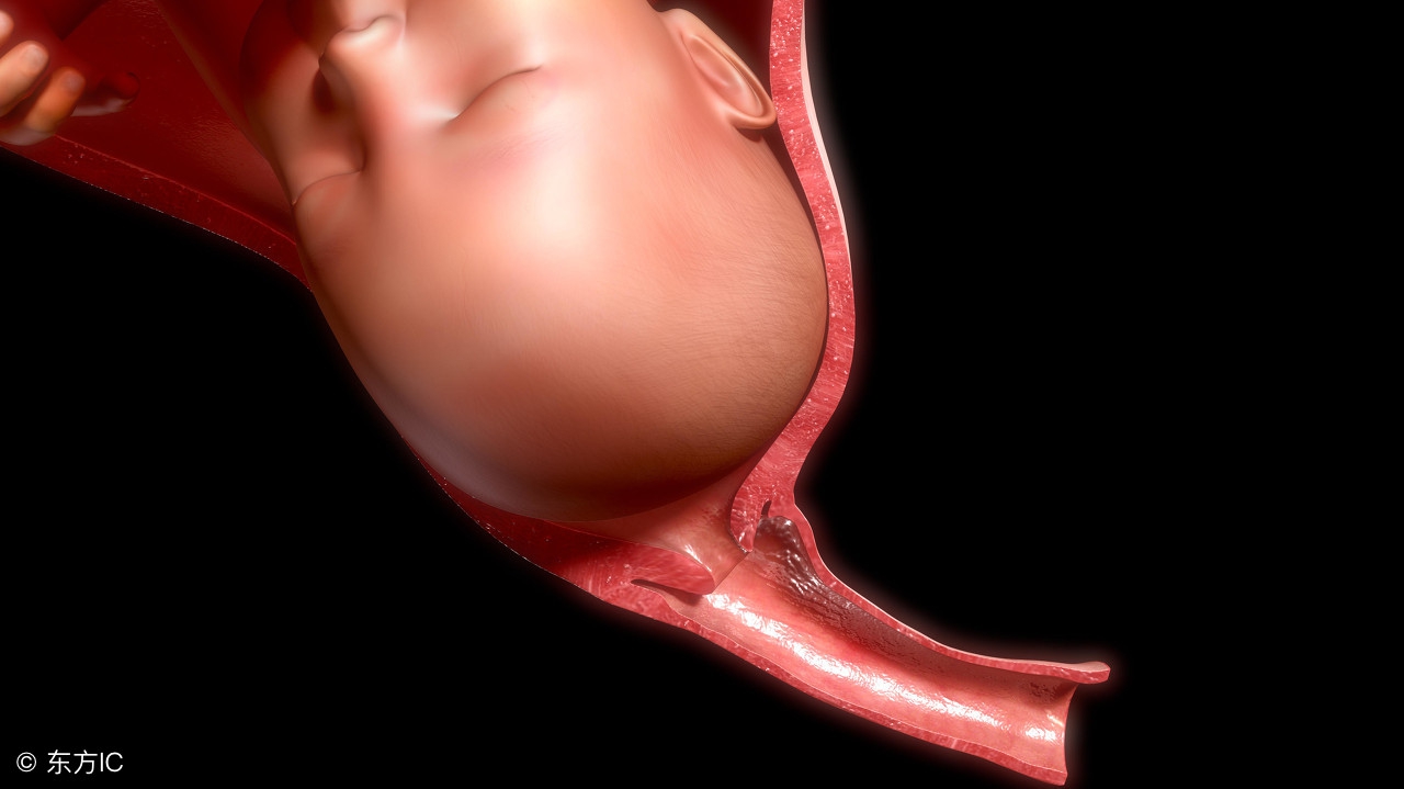 宫颈机能不全反复自然流产的妈妈，宫颈环扎术为您带来“好孕”