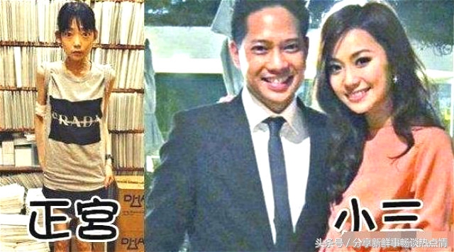 因为老公一句话得了厌食症怎么办,因老公一句话疯狂减肥