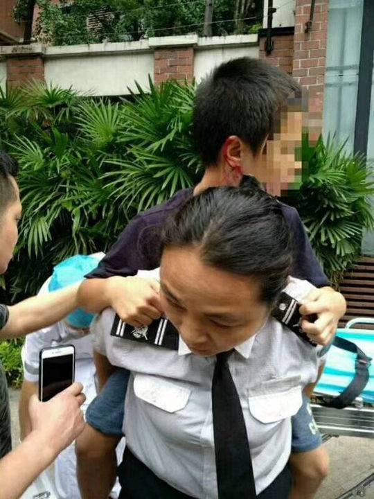 德牧被未牵绳主人暴打,在城市小孩被德牧咬伤怎么赔偿