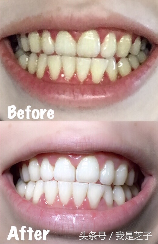 白牙小妙招1天见效,白牙的秘诀