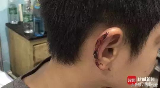 遇到狗咬人怎么自救,遇到狗狗攻击自救方法