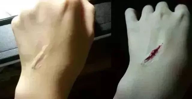 快停手！钻鼻子、撕脸皮、割下巴“抖音易容”*法大**实在太可怕！