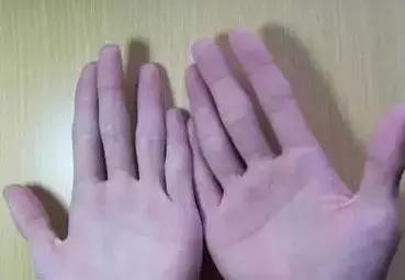 健康手掌颜色,手掌健康颜色