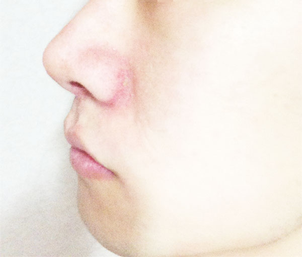 这支异军突起的木瓜膏，它到底有什么好？