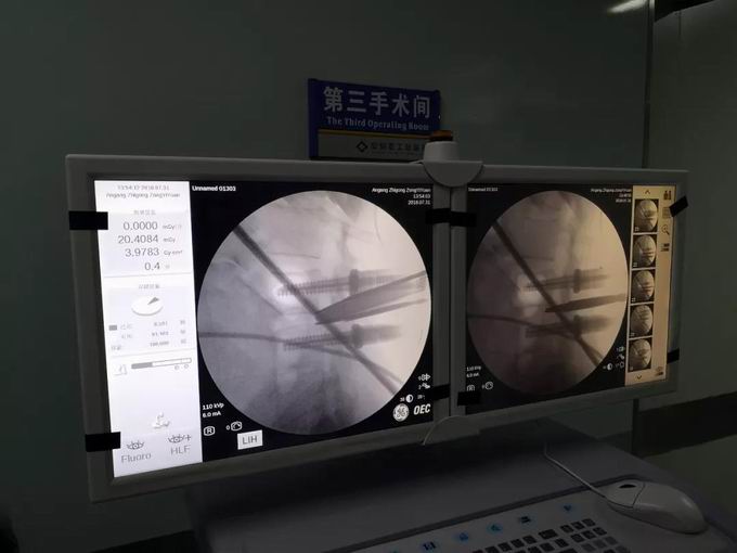 安阳市安钢总医院骨科专家,安钢医院脊柱微创中心主任名单