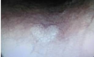 当内镜遇到情人节……