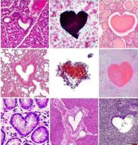 当内镜遇到情人节……