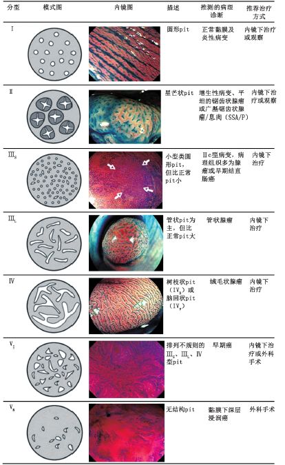 容易便血的痔是什么痔,便中带血是寄生虫吗