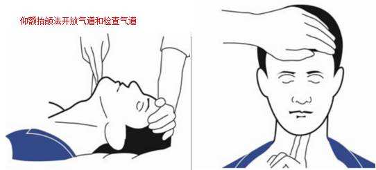 心肺复苏的抢救流程及原则,心肺复苏抢救成功后注意事项