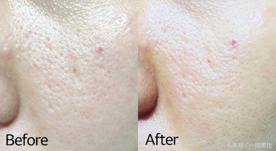 drje面膜真实测评,drjart面膜的正确使用方法