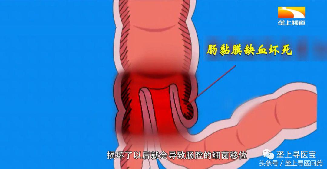 1岁半宝宝为何哭闹不止?原是它在作祟!宝宝出现这4种症状要当心