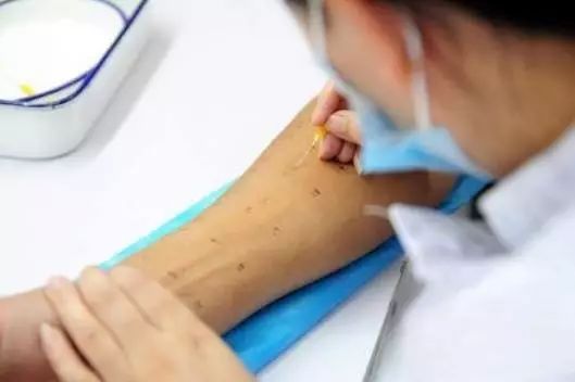 眼睛痒打喷嚏过敏怎么办,喷嚏鼻痒感冒吃什么药