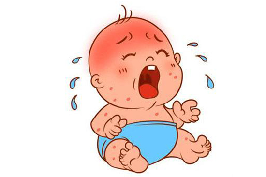 宝宝湿疹宝妈可以喝骨头花生汤吗,宝宝长湿疹宝妈们有什么办法