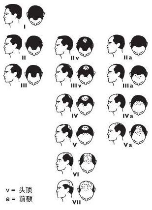 清朝为什么要把额头前的头发剃光,清朝砍头要把辫子提起来吗