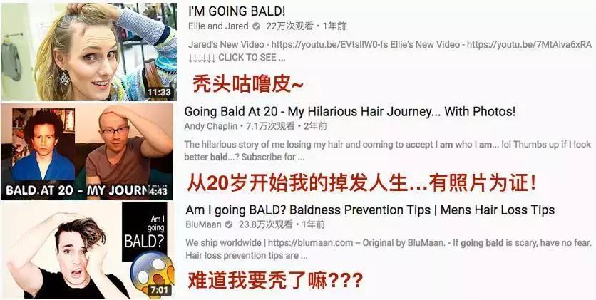 发际线高脱发用什么洗发水,发际线高掉头发洗发水测评