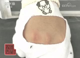 夏天蚊子多贴防蚊贴有用吗,夏季蚊子多蚊帐也没用