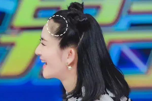 防脱发女生,防脱发明星代言哪个好