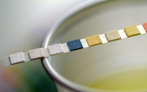 怀孕得了尿路感染怎么办,怀孕了尿路感染可以吃左氧氟沙星