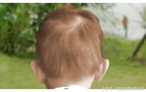 婴幼儿缺铁性贫血怎么补最快,婴幼儿缺铁性贫血的危害及表现