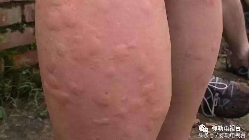 弥勒蚊虫消杀,弥勒病媒消杀