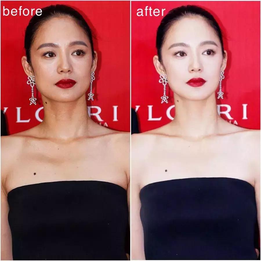 除了发量,最暴露年龄的可能是这两道纹