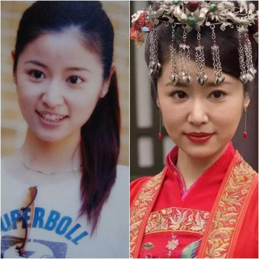 除了发量,最暴露年龄的可能是这两道纹