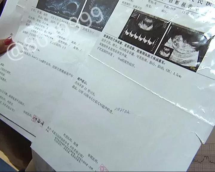 孕妇当场大出血,警方辟谣孕妇大出血求助