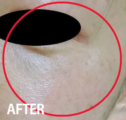 pola新款去皱精华,pola十月新款贵妇面霜