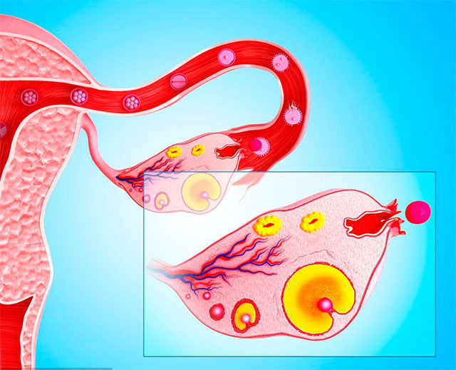 卵巢年轻的女人,来月经时会有4个习惯,你若有2个以上,那也很好
