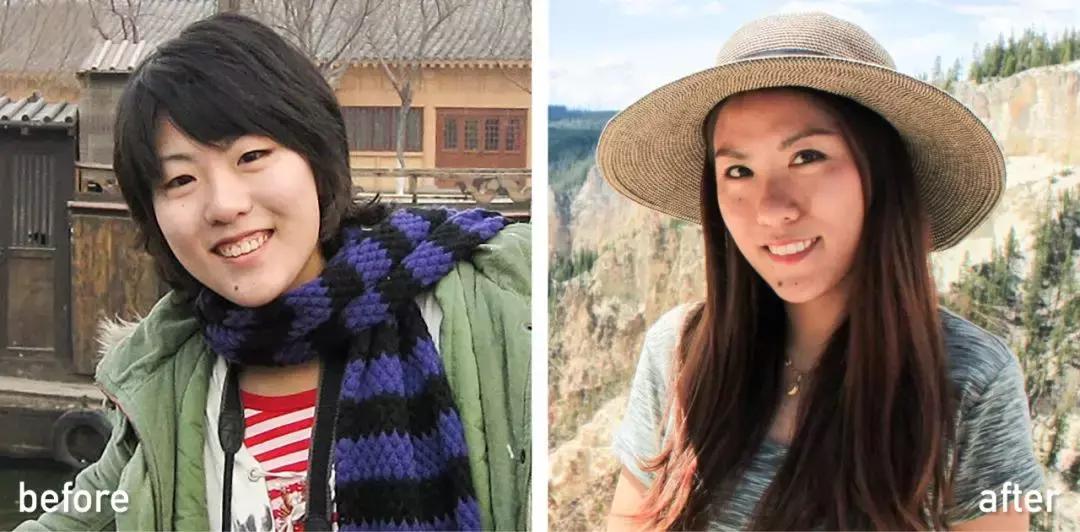 60岁整容亲身经历,整容亲身经历真的好吗