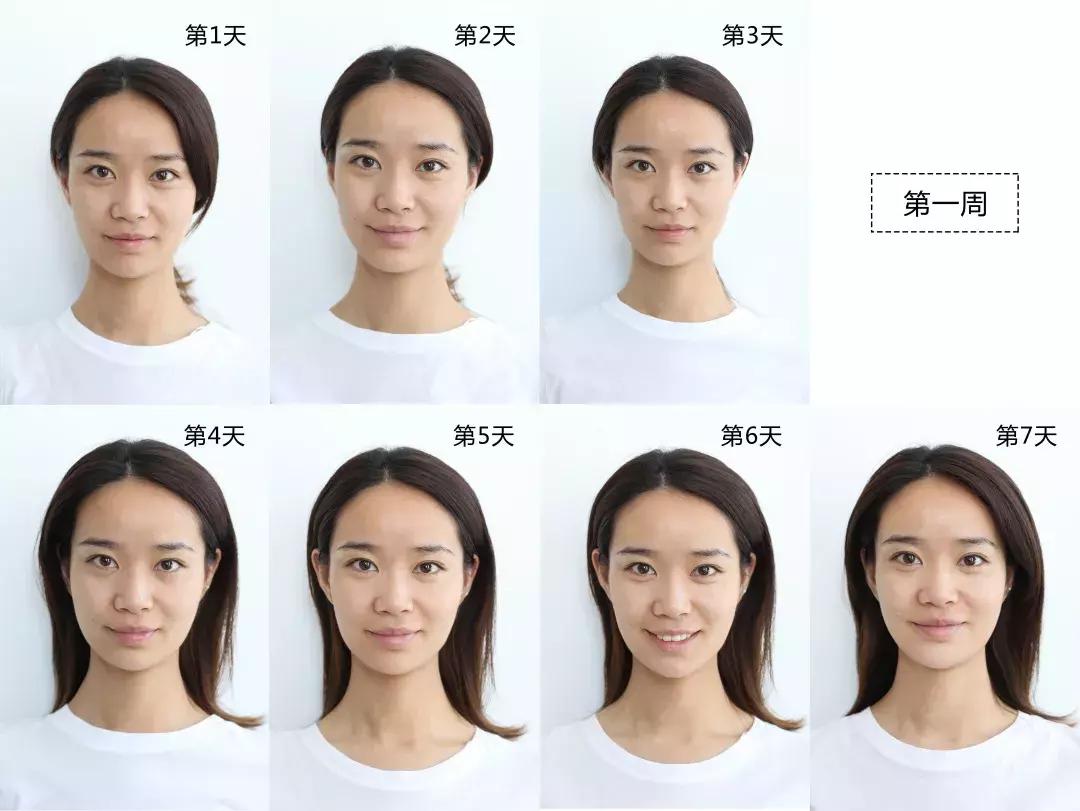 vc精华淡化法令纹暗沉,vc用了法令纹发黄