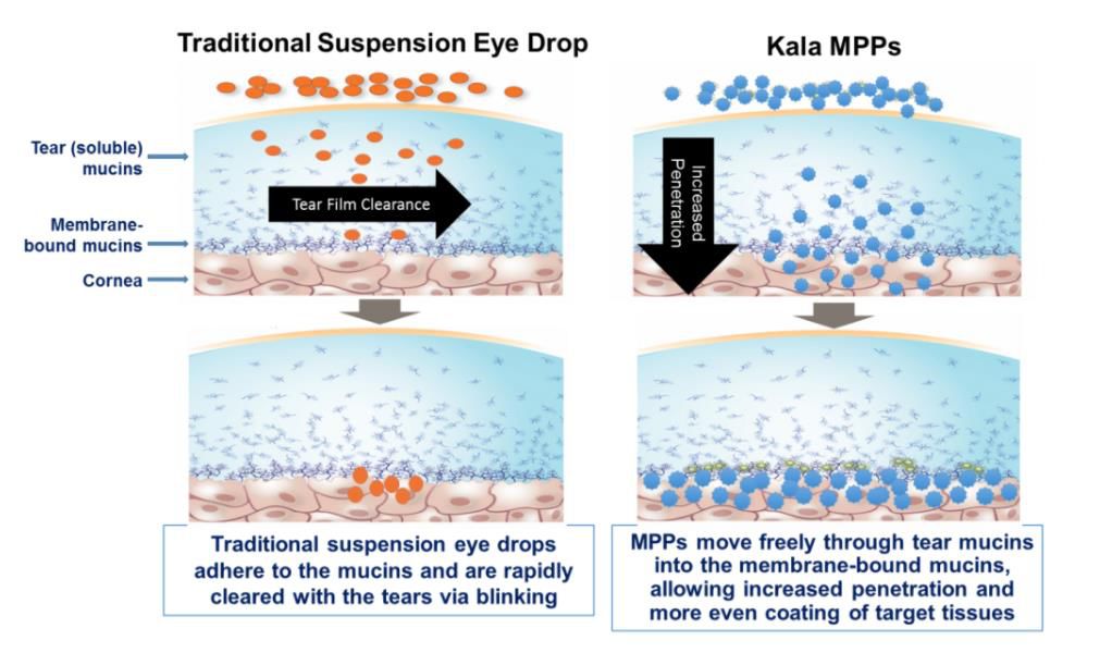 近期已问世和最值得期待的干眼症治疗新药和设备